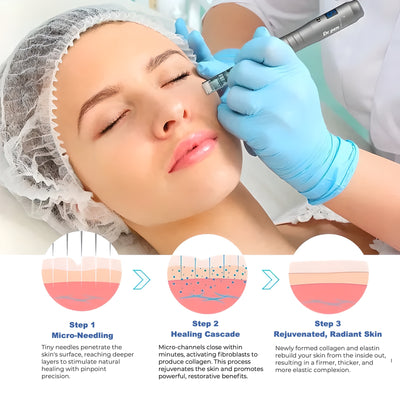 Dr. Pen M8: High-Velocity Transdermal Microneedling System